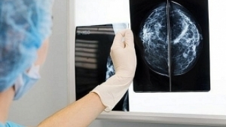 Д-р Диков - онкорентгенолог-мамолог, преглежда на 13 декември 20